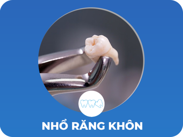 Nhổ răng khôn an toàn