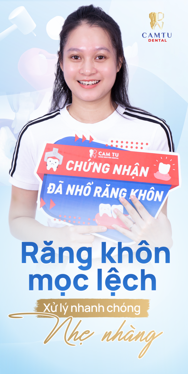 Nhổ Răng Khôn Mọc Lệch – Xử Lý Nhanh Chóng, Nhẹ Nhàng tại Nha Khoa Cẩm Tú