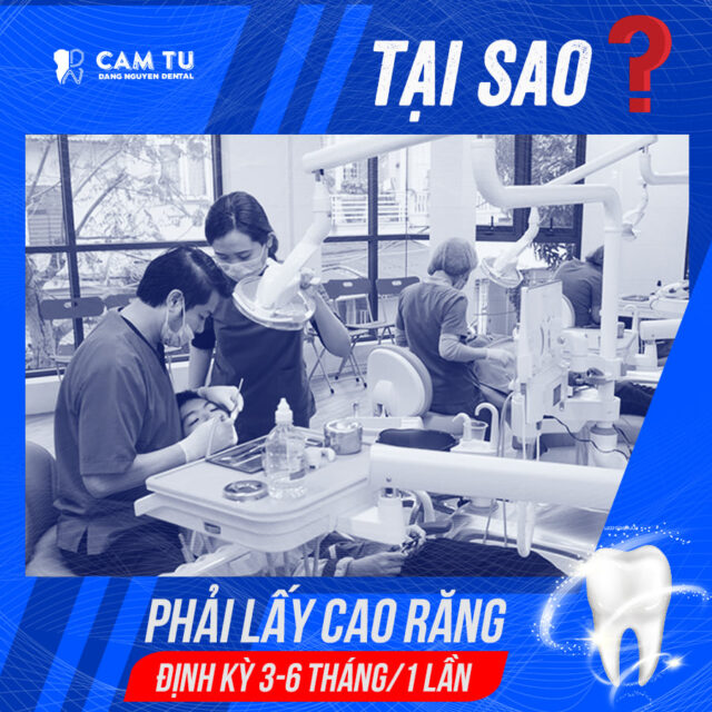 Lấy cao răng trước Tết
