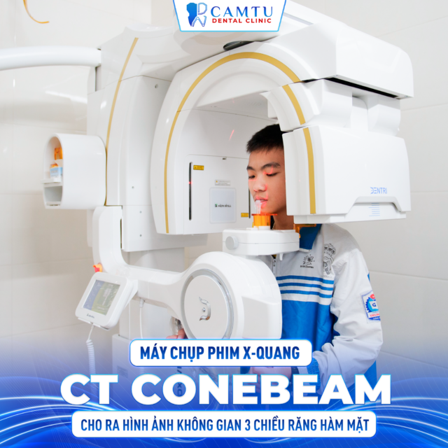 Chụp x-quang nha khoa có an toàn không