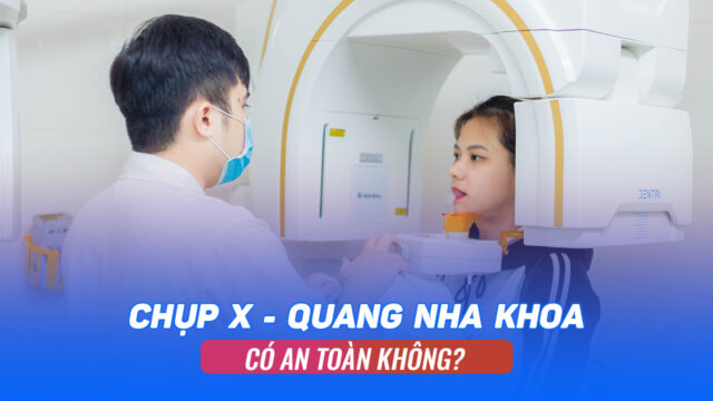 Chụp X–quang nha khoa có an toàn không?