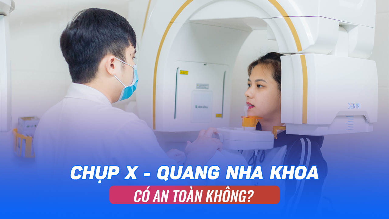 Chụp X–quang nha khoa có an toàn không?