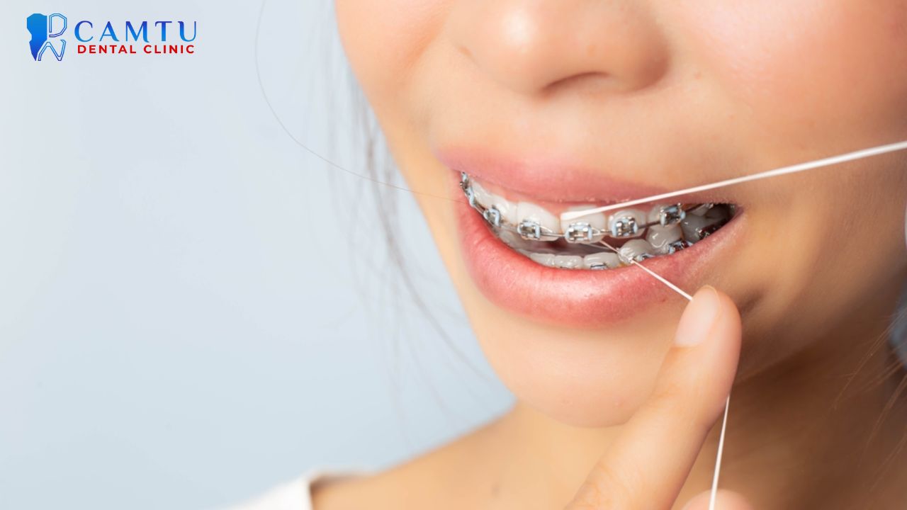 Cách dùng chỉ nha khoa