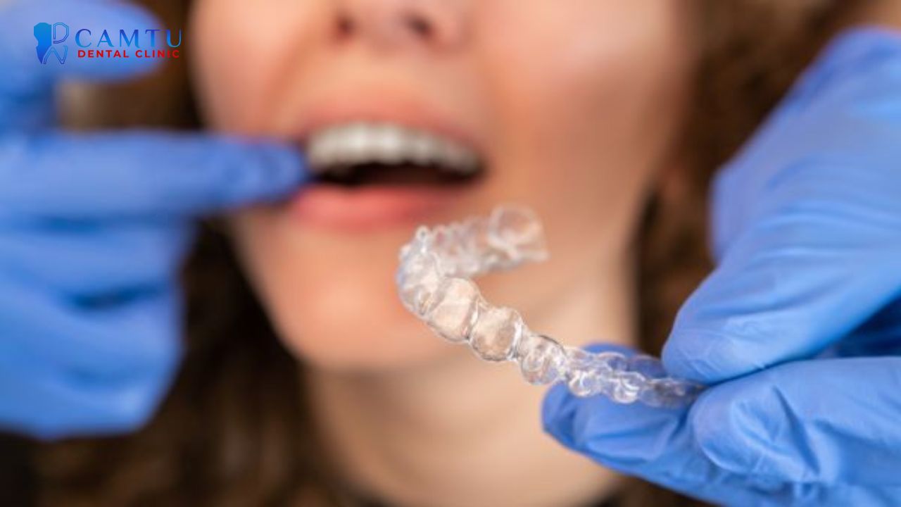niềng răng invisalign Comprehensive 5
