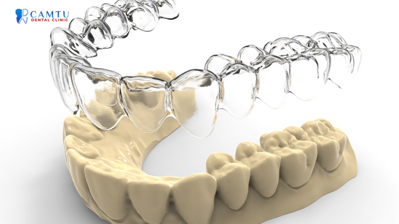 niềng răng invisalign essential
