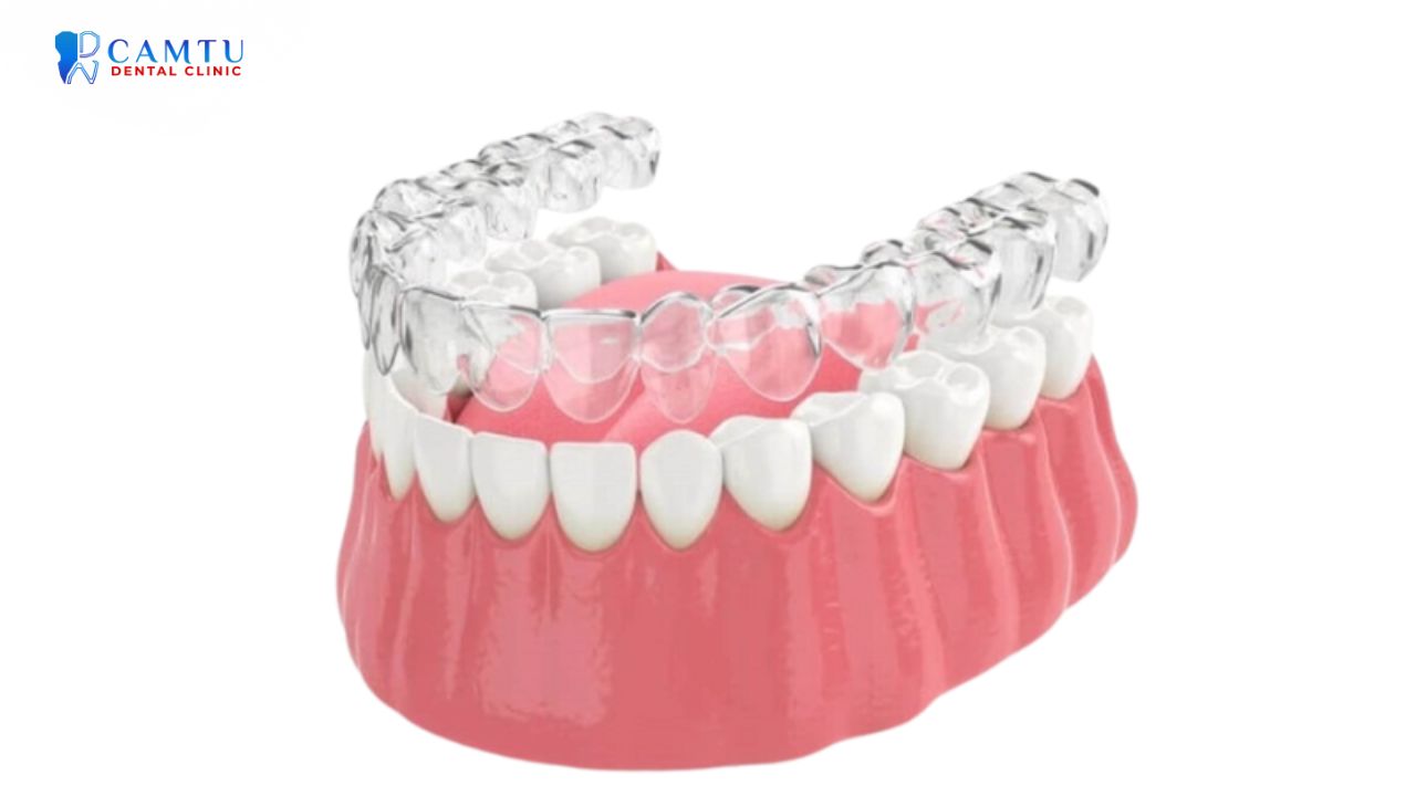 niềng răng invisalign essential