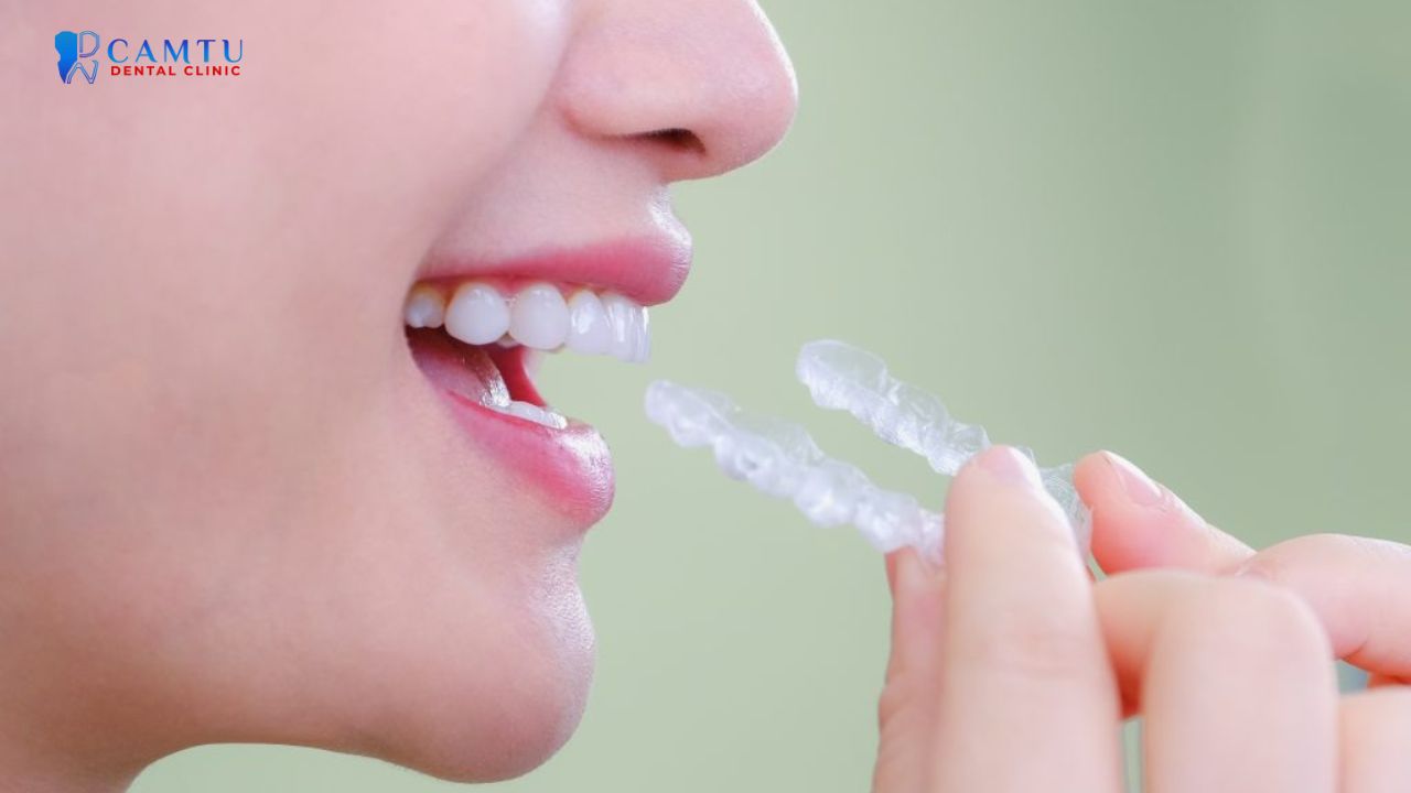 niềng răng invisalign essential