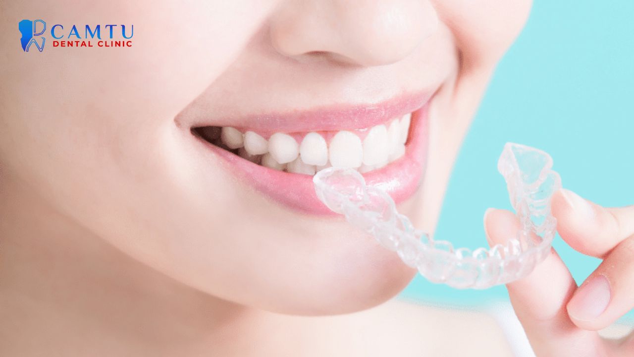 niềng răng invisalign express