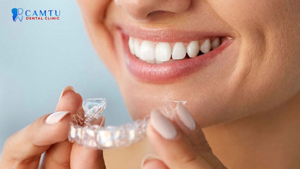 niềng răng invisalign moderate
