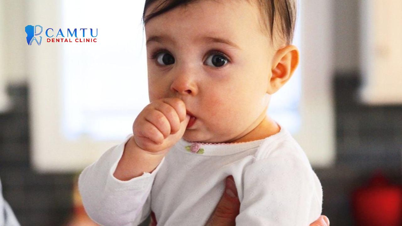 Thói quen mút tay từ nhỏ có thể là nguyên nhân dẫn đến sai khớp cắn loại 2.