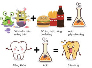 nguyên nhân sâu răng do mảng bám và đồ ngọt