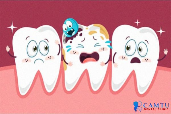 Bệnh răng miệng là gì