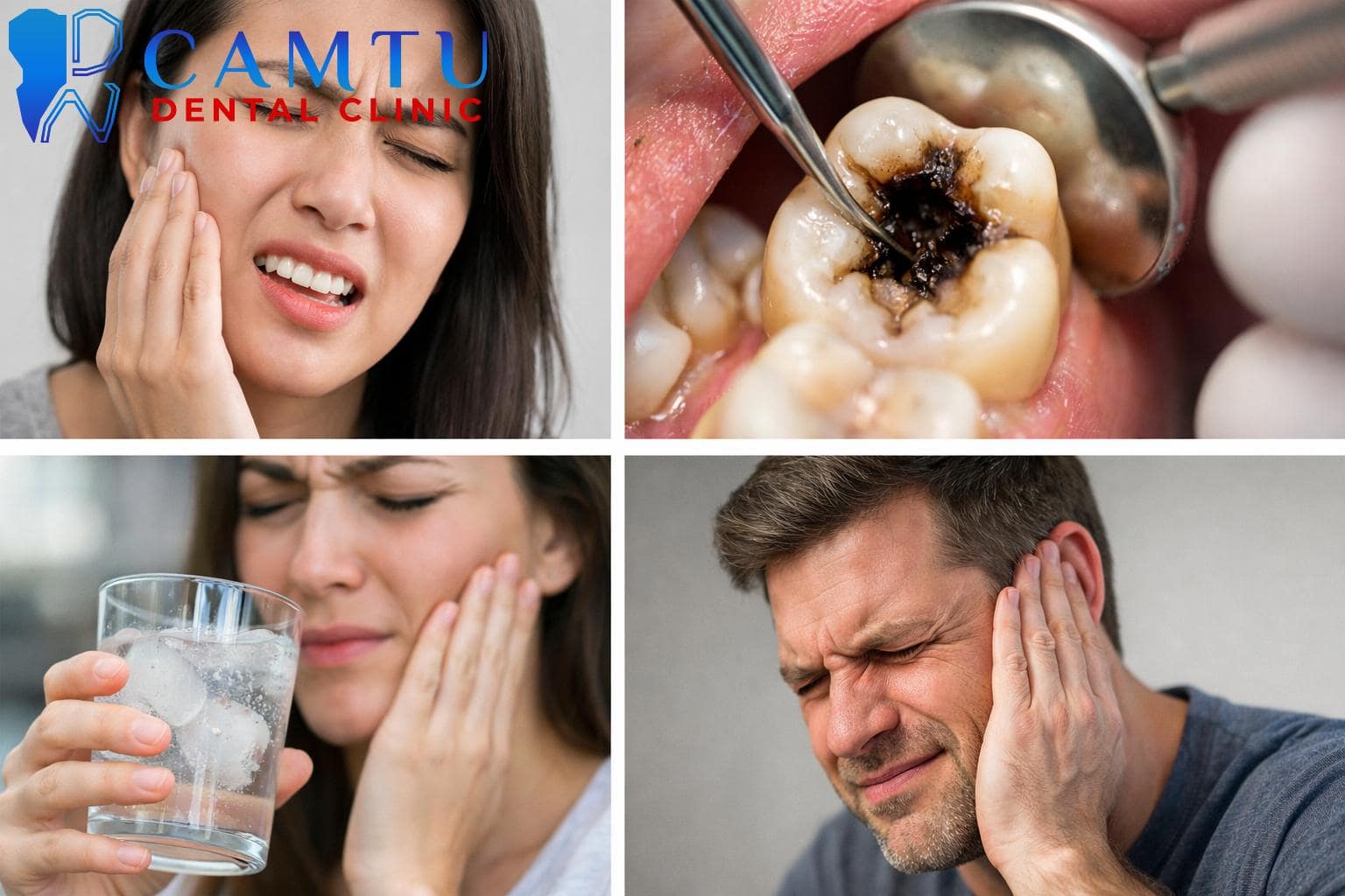 Triệu chứng viêm tủy răng thường gặp