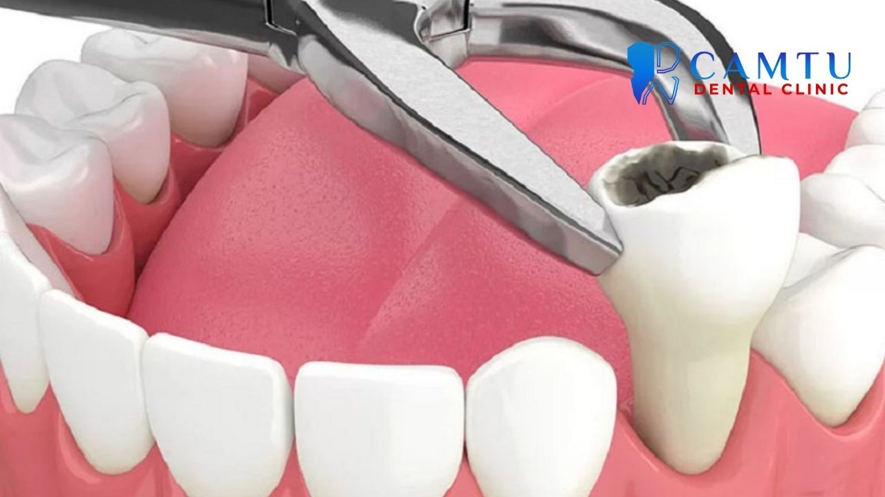 Bảo hiểm y tế răng hàm mặt