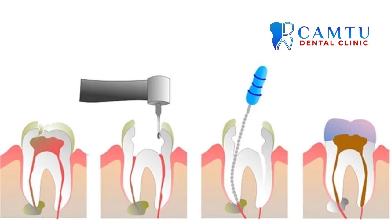 Bảo hiểm y tế răng hàm mặt