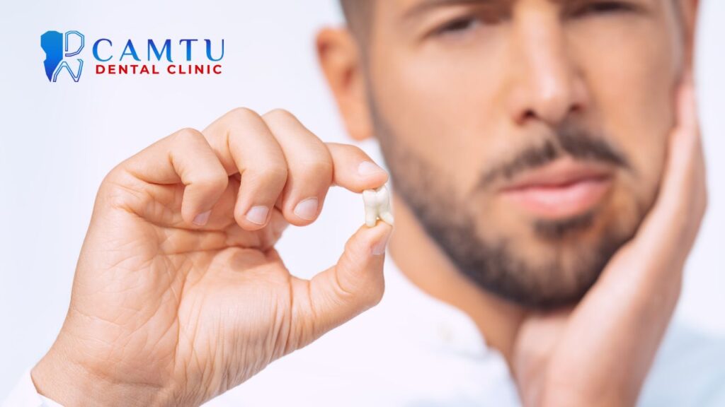 biến chứng sau khi nhổ răng khôn