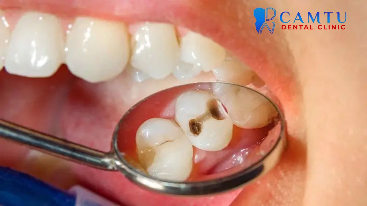 Chăm sóc răng miệng cho phụ nữ mang thai