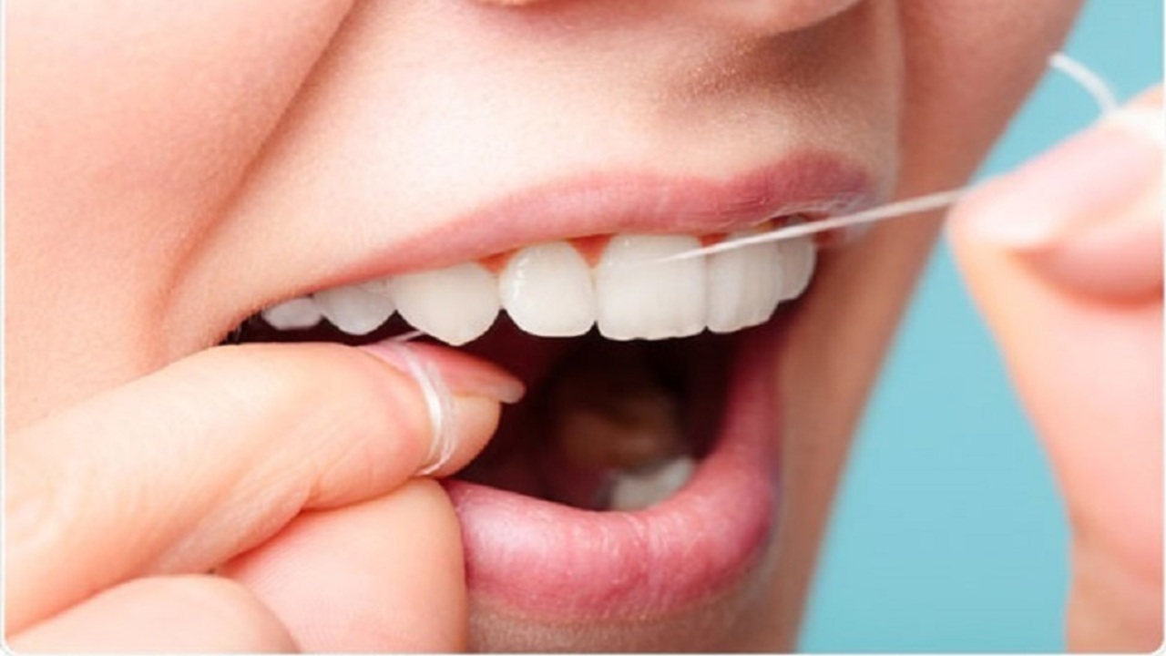 Cách phòng ngừa cao răng hiệu quả