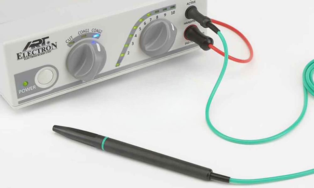 Phẫu thuật cắt lợi