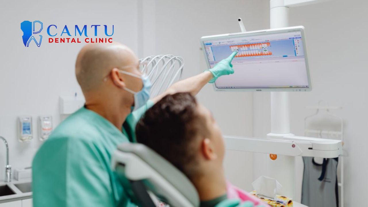 Răng hô nên niềng hay bọc sứ