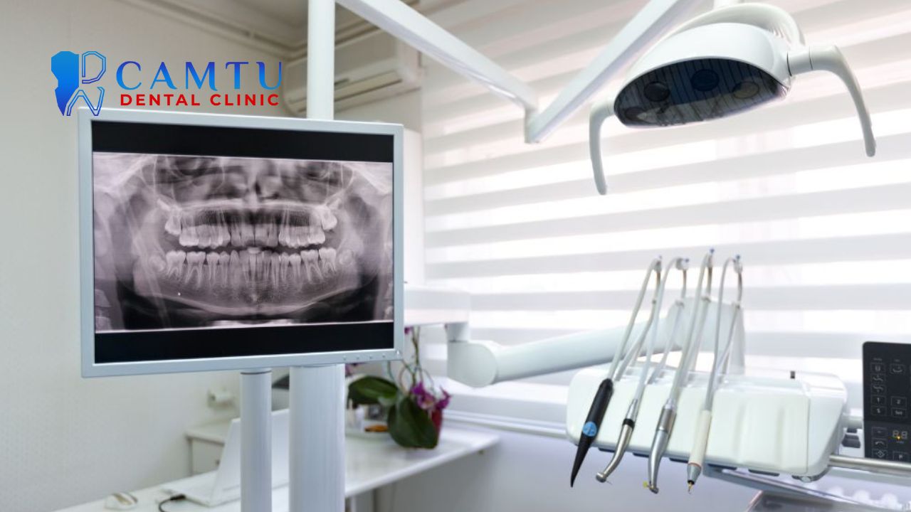 Răng hô nên niềng hay bọc sứ