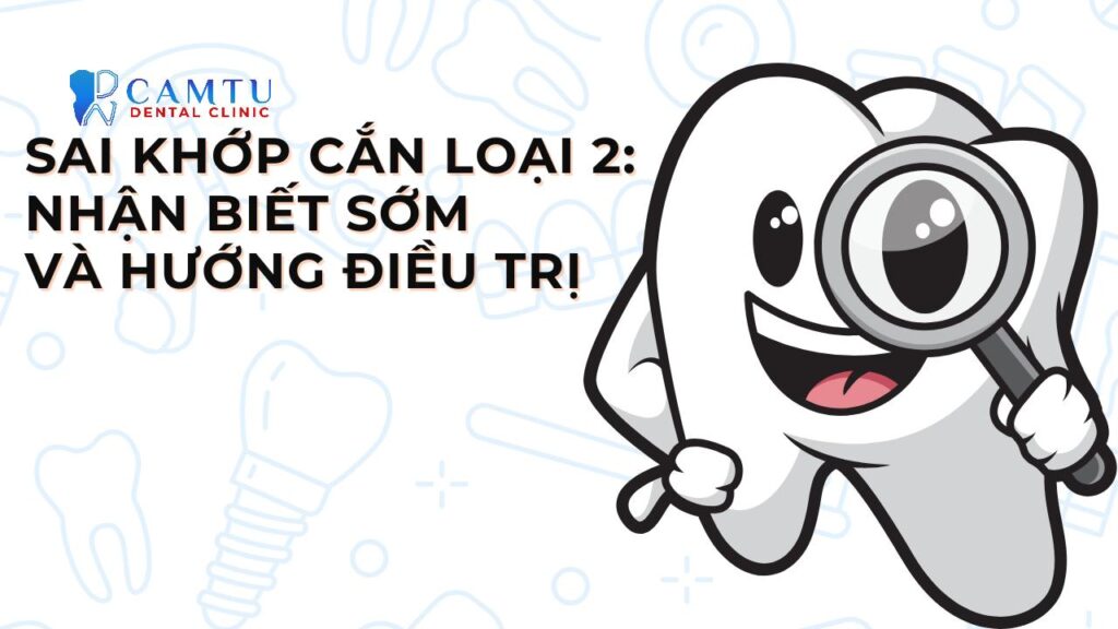 Sai khớp cắn loại 2