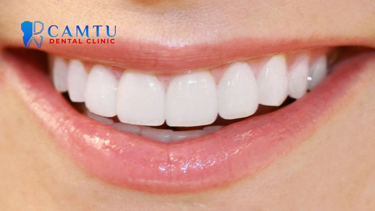 xu hướng nha khoa thẩm mỹ