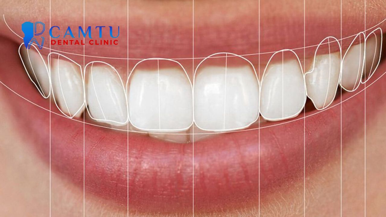 xu hướng nha khoa thẩm mỹ