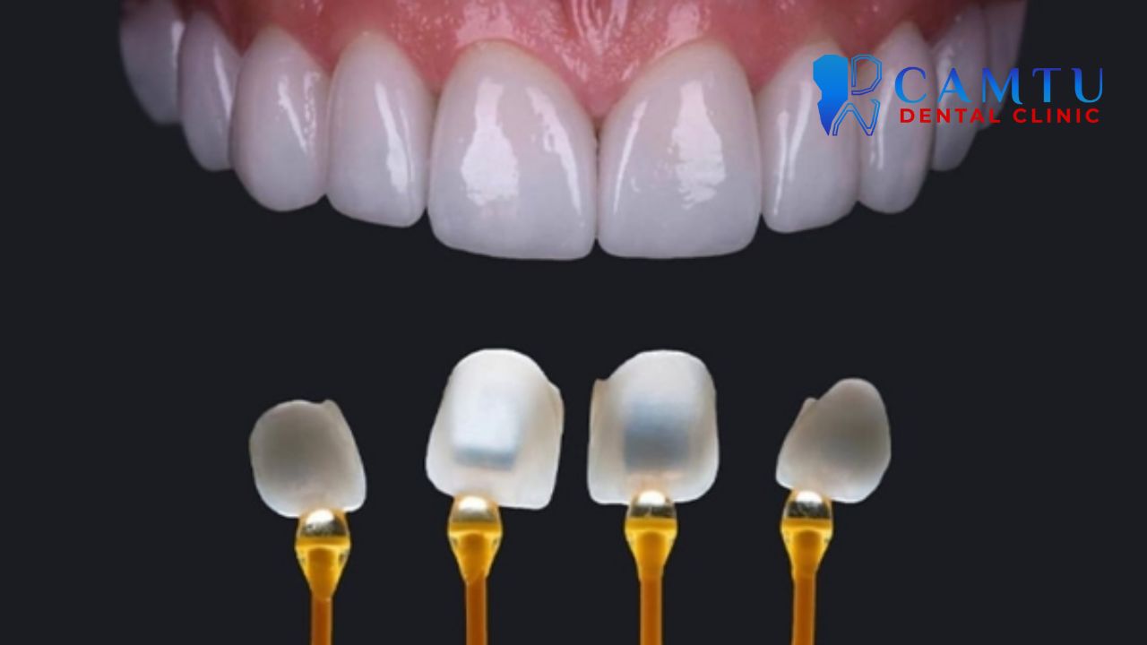 xu hướng nha khoa thẩm mỹ