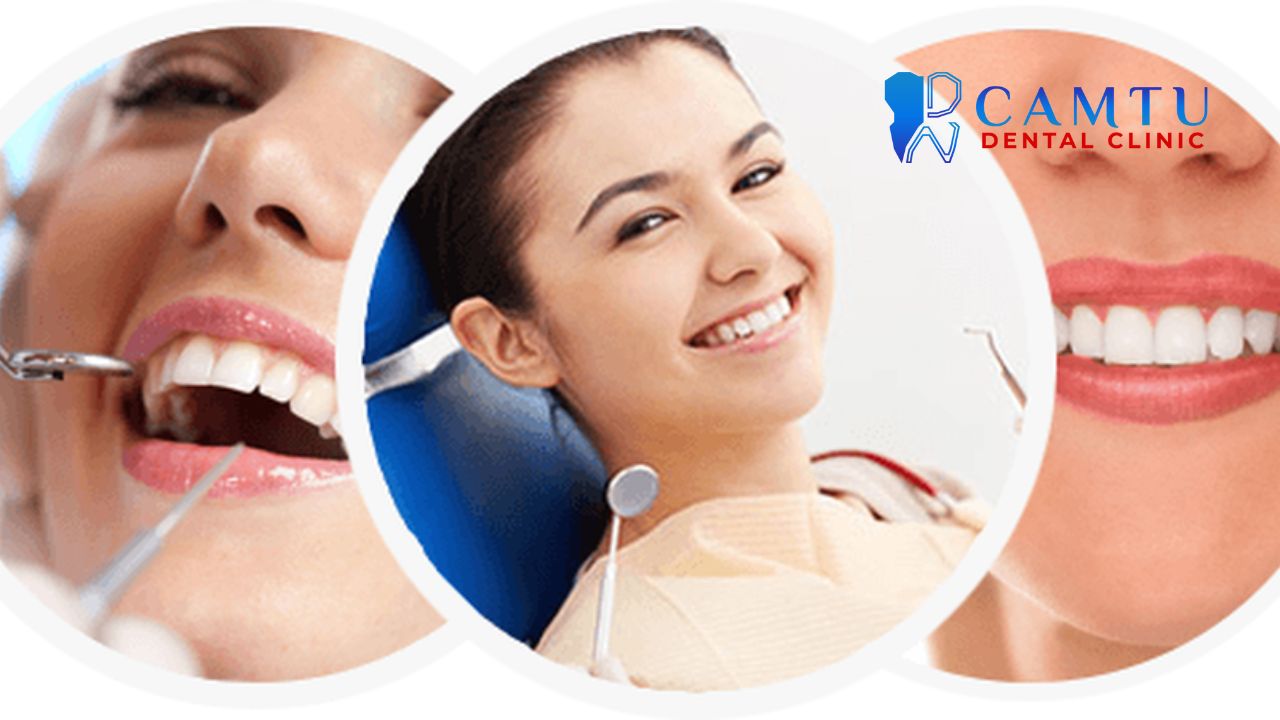 xu hướng nha khoa thẩm mỹ