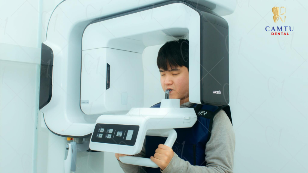 Chụp phim Cone Beam CT (CBCT)