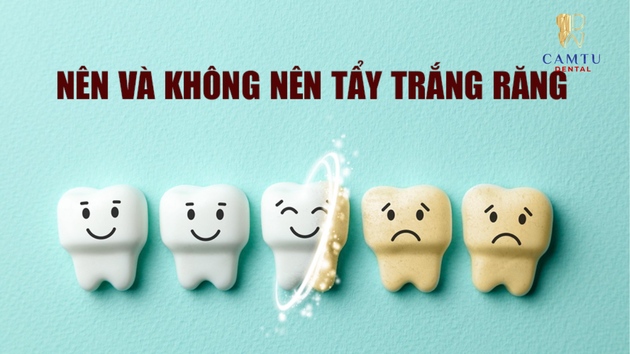 Ai nên và không nên tẩy trắng răng?