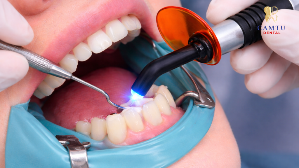 Phục hồi răng sau khi điều trị tủy