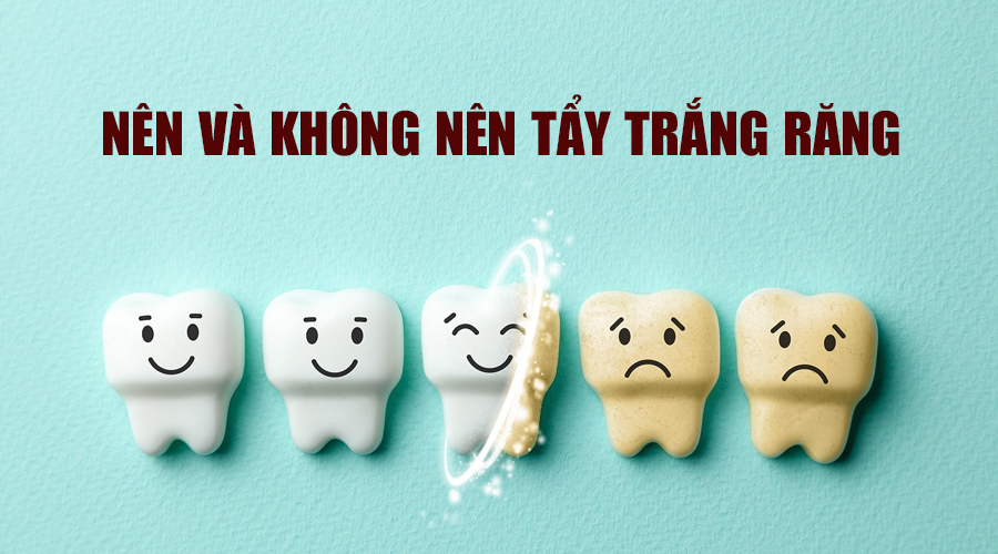 Ai nên và không nên tẩy trắng răng?