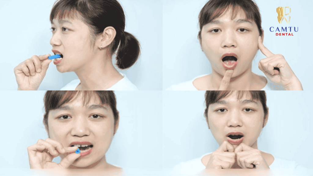 Phòng ngừa và điều trị hiệu quả