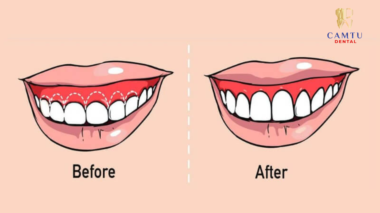 Khác biệt nằm ở đối tượng