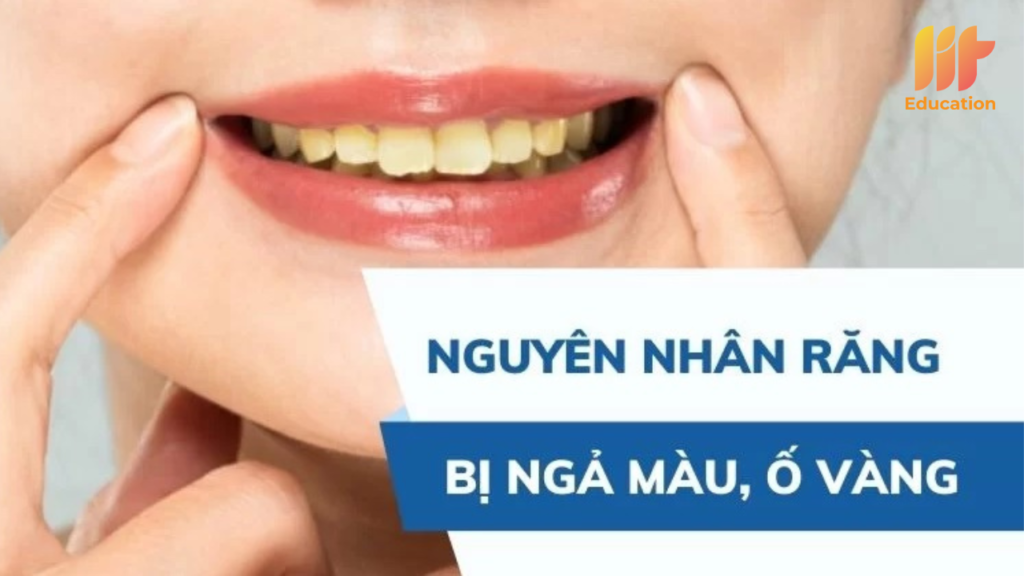Nguyên nhân khiến răng bị xỉn màu