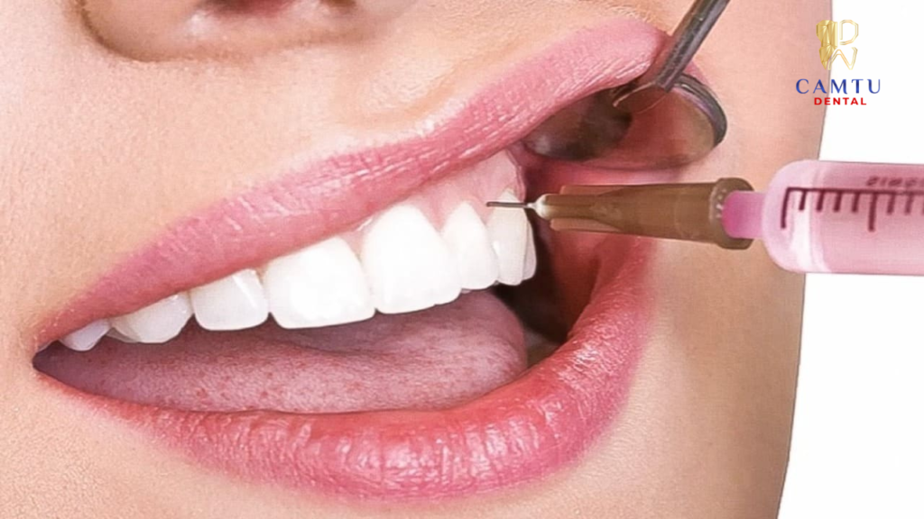 Tiêm thuốc tê khi nhổ răng