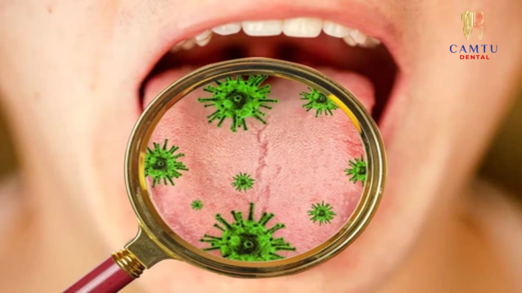 Vi khuẩn trong khoang miệng