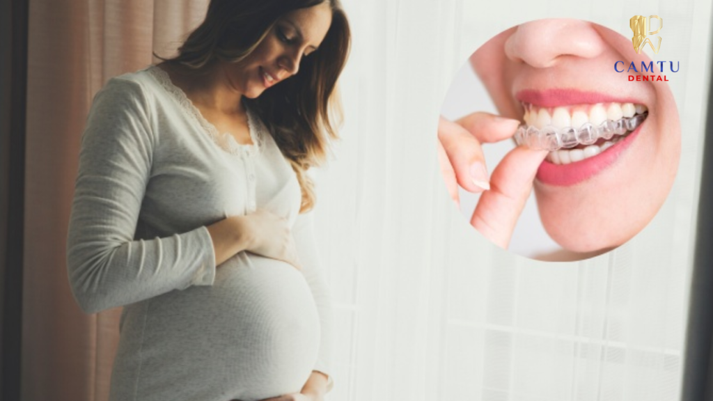 Nếu đã niềng răng trước khi mang thai thì phải làm gì?