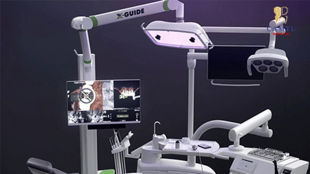 Công nghệ X-Guide.