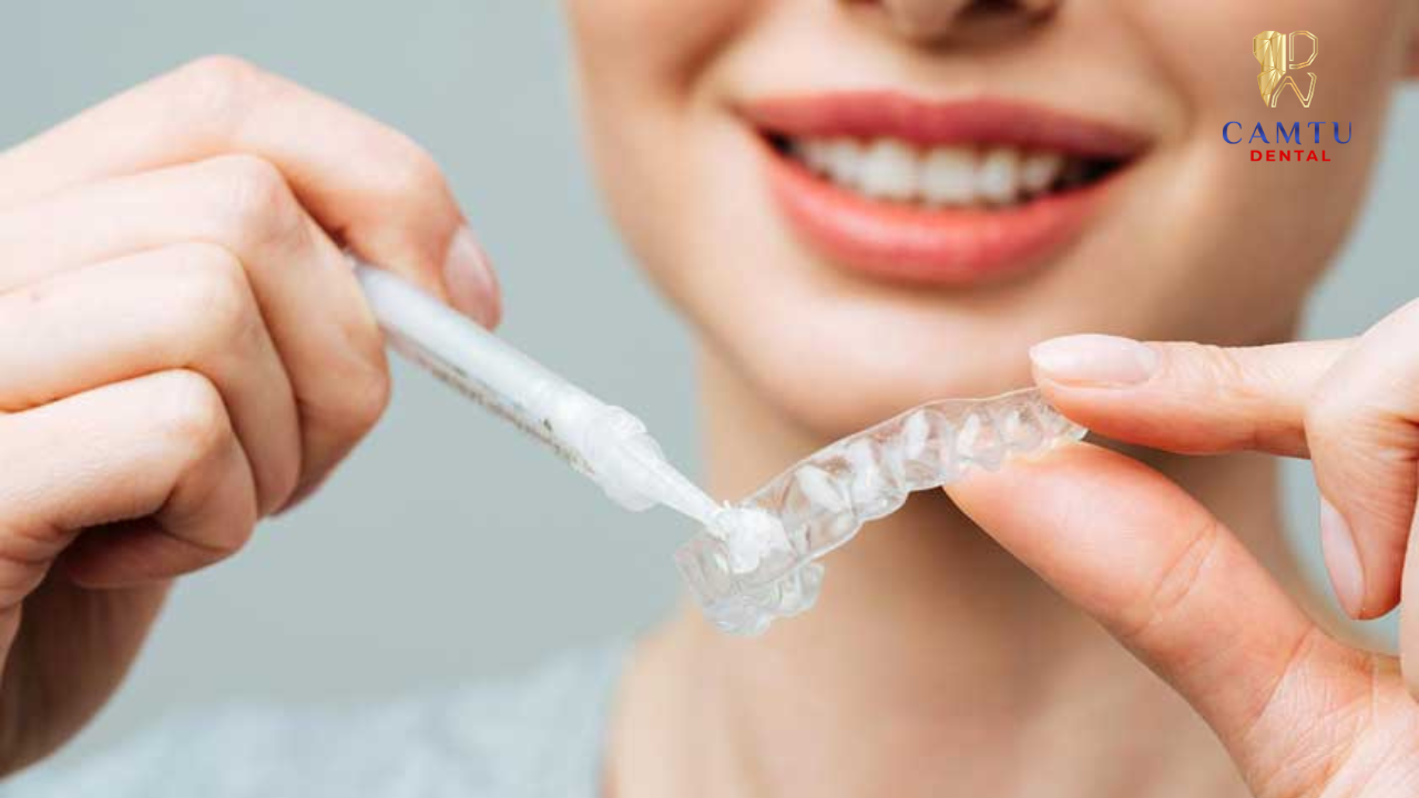 Tẩy trắng răng tại nhà