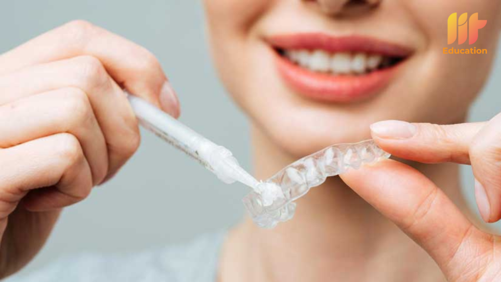 Tẩy trắng răng tại nhà