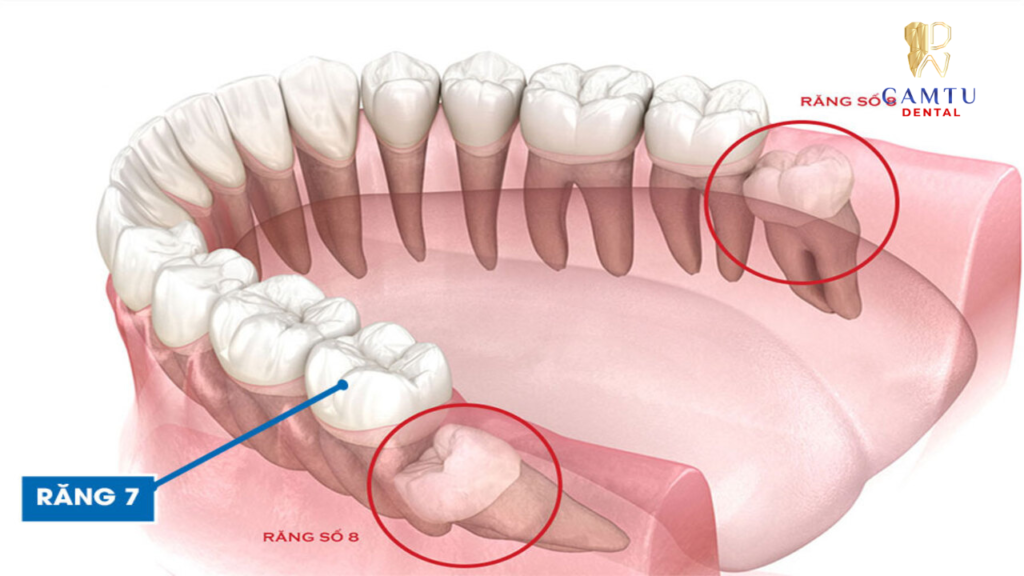 Vị trí của răng số 7 nằm ở đâu?