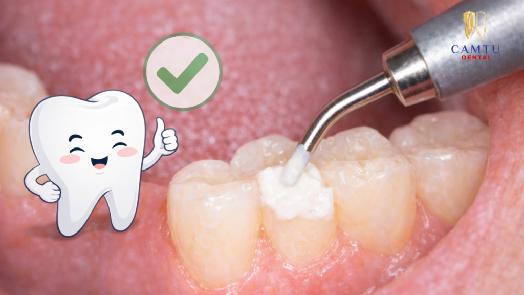 Ít gây kích ứng mô răng