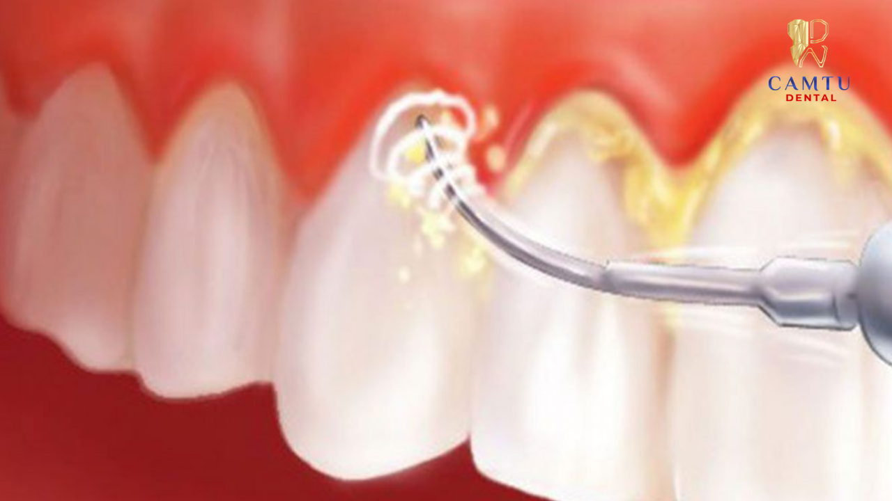 Sẽ nguy hiểm nếu không điều trị kịp thời