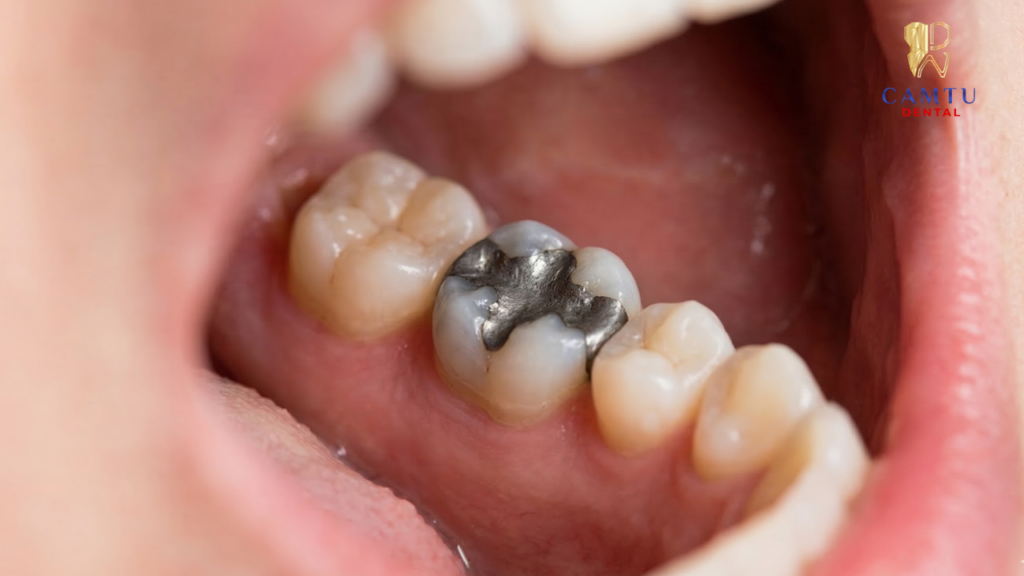 Màu sắc kém thẩm mỹ