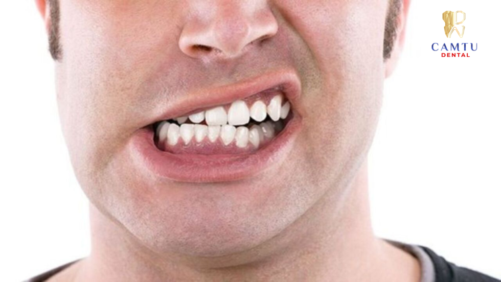 Gây khó khăn cho hoạt động ăn uống, nói chuyện