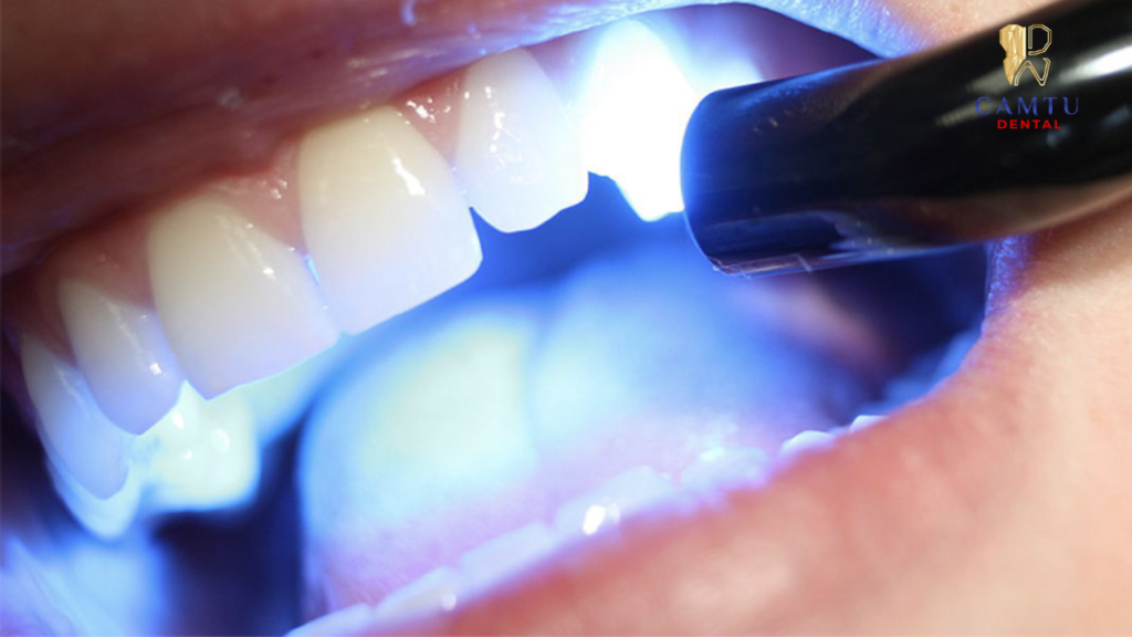 Chiếu đèn quang trùng hợp làm cứng vật liệu