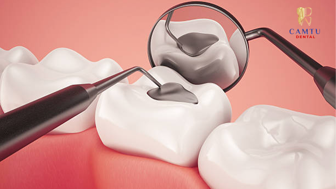 Ê buốt, dễ tụt nướu là một trong những dấu hiệu thường gặp